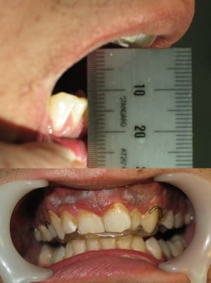 Temp gjbpu7 - Eugenol