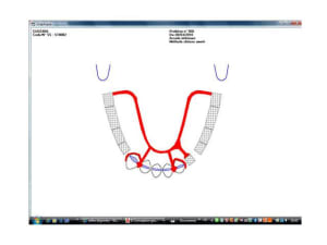 Trac  t8kpwg - Eugenol