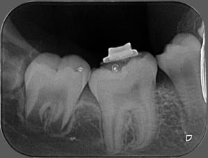 Unknown x 2012 03 21 11 33 51 4 bkdqar - Eugenol