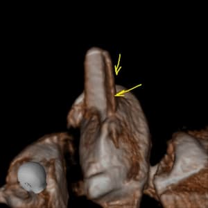 Volumerenderer g45kdj - Eugenol