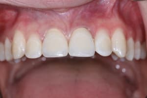 Vue face ccc e0bfce - Eugenol