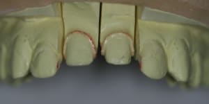 Vue face mod le pd2qsa - Eugenol