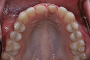 Vue sup taille n0fqa0 - Eugenol