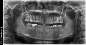 Wang jianni 2 r8loq7 - Eugenol