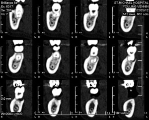 Youling vennin eqnjgk - Eugenol