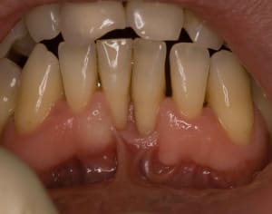  mg 0051 qb6u2p - Eugenol