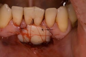  mg 0059 dprwa9 - Eugenol