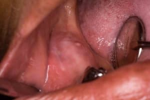  mg 0115 xv6uoq - Eugenol