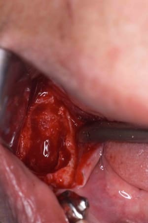  mg 0120 h011yi - Eugenol