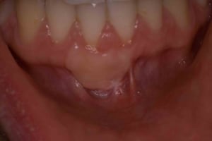  mg 0169 x3oou0 - Eugenol