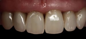  mg 1702 xzocjy - Eugenol