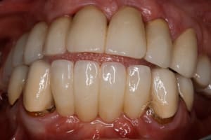  mg 1949 mwqxr7 - Eugenol