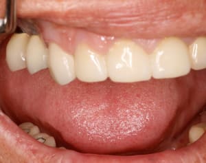  mg 2092 jw8ng1 - Eugenol