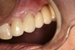  mg 6424 aeia7y - Eugenol