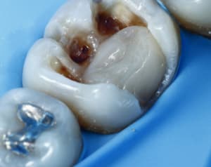  mg 7631 pcldig - Eugenol