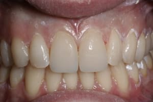  mg 7689 trwxb8 - Eugenol