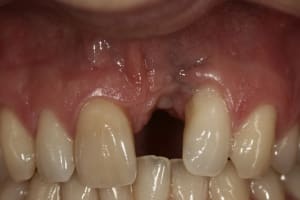  mg 8338   copie g5yhrk - Eugenol