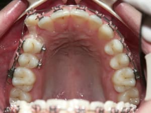 A13 esyt5s - Eugenol