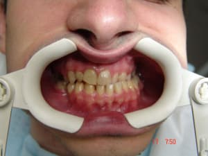 Ac3 vvb6ab - Eugenol