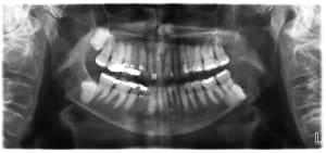 Agddeisfosxr0lnebbbm - Eugenol