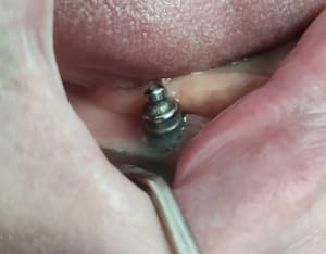 Aio1dpisteqqlzvxq0en - Eugenol