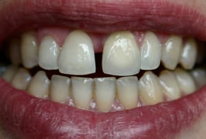 Ap2 sdd5hd - Eugenol