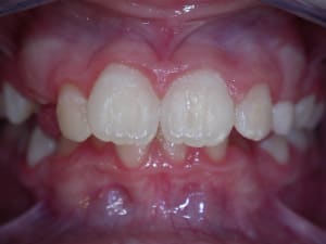 Apr s qh lhtdbu - Eugenol