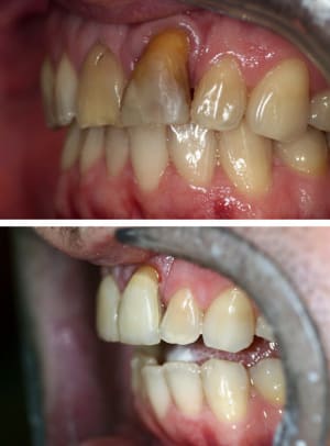 Av ap vue laterale stww83 - Eugenol