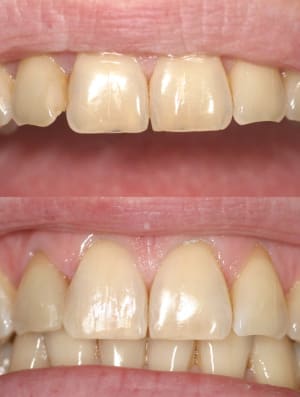 Av ap web jcolqd - Eugenol