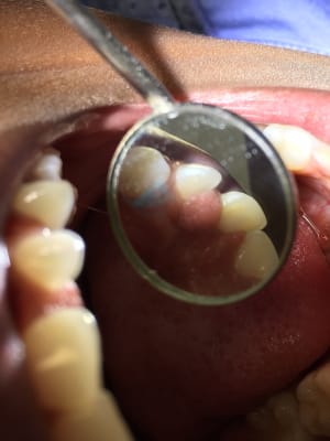 Av6wo2frydtnbwlmep5y - Eugenol