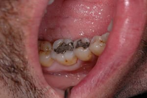 Avant xen5gj - Eugenol