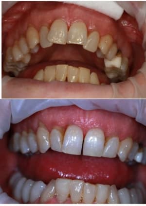 Avap2 e48hha - Eugenol