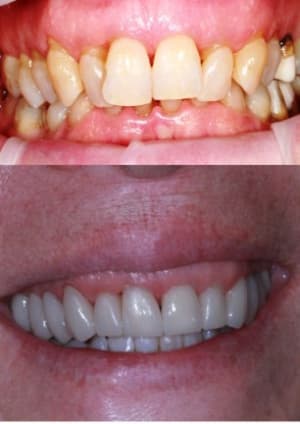 Avap4 dtoy1i - Eugenol