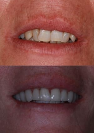 Avap5 wrh1yy - Eugenol