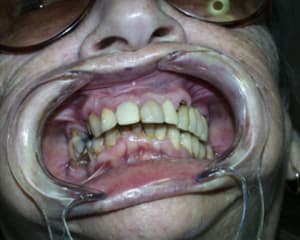 Aya7 t3ryck - Eugenol