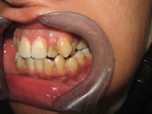 Bilan orthodontie hanguag sihm 006 jld6be - Eugenol