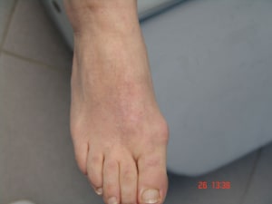 Bn2 ezgfmd - Eugenol