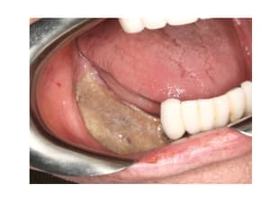 Bonekey20110500 f1 o9zotb - Eugenol