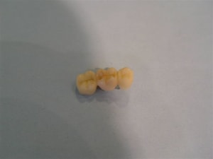 Bridge temp 2 vnlvg1 - Eugenol