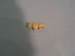Bridge temp xo1rm4 - Eugenol