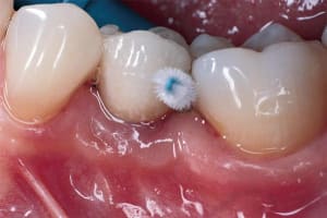 Brossette interdentaire avpjfu - Eugenol