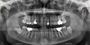 Bvywxeem7ret22bo9yicei3cwj6z - Eugenol