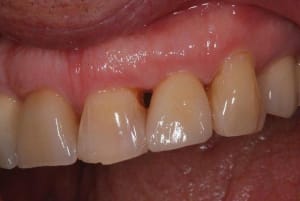 C ramzircone mtui4u - Eugenol