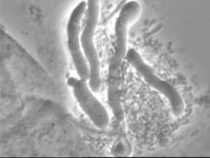 Candida bourgeons gpixrn - Eugenol