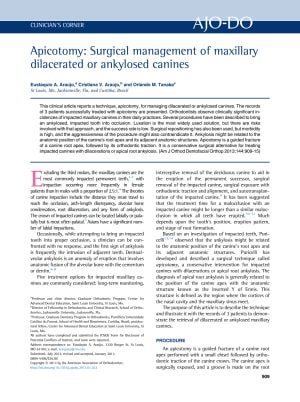 Canine incluse otraxy - Eugenol