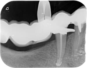 Cantilever x 2012 07 31 18 21 27 4 wtwaxe - Eugenol