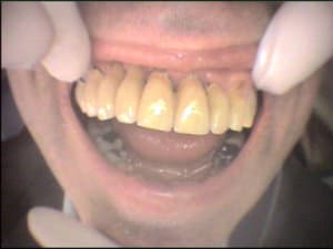 Cas 3 3 z8jrsx - Eugenol