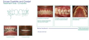 Case2after zdq4xy - Eugenol