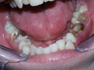 Cata3 whkunc - Eugenol