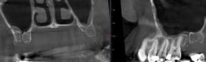 Cbs vlakvn - Eugenol